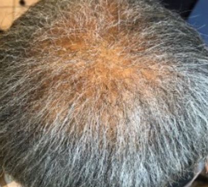 Before - SEPTEMBER 12, 2019